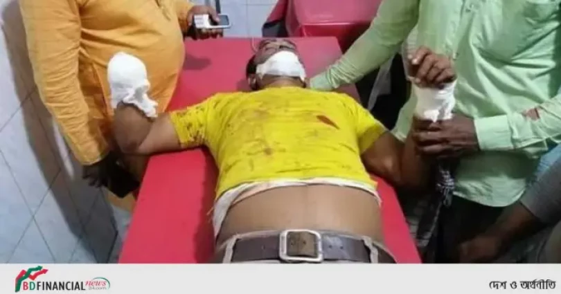লালমোহনে মোবাইলে ডেকে নিয়ে স্বেচ্ছাসেবক লীগ নেতার হাতের কব্জি কর্তন