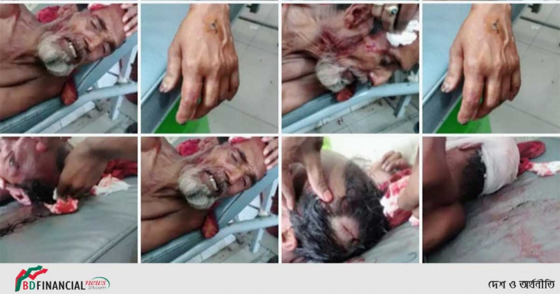 চুনারুঘাটে ভাতিজার দায়ের কোপে চাচা-চাচী গুরুতর আহত
