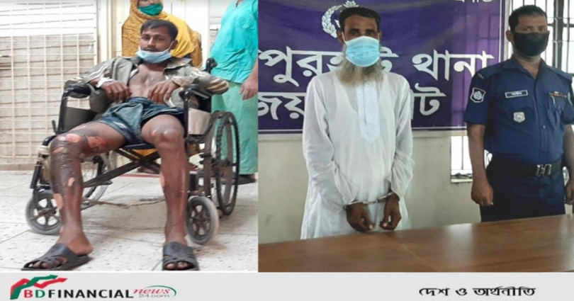 রিকশা চালকের দুই পায়ে আগুন দিয়ে ঝলসে দেওয়া ইউপি সদস্য গ্রেপ্তার